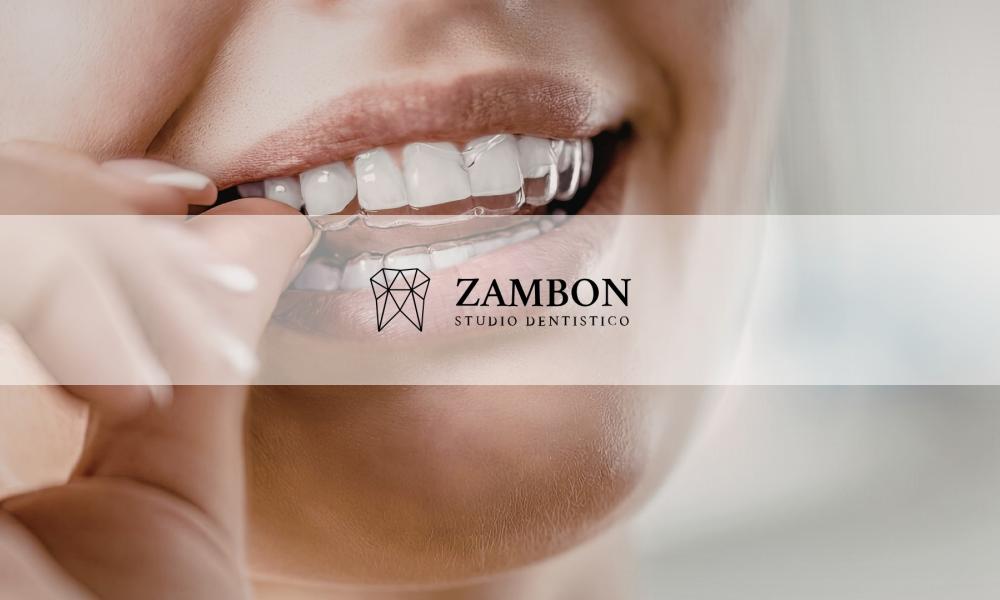 ALLINEATORI DENTALI PADOVA