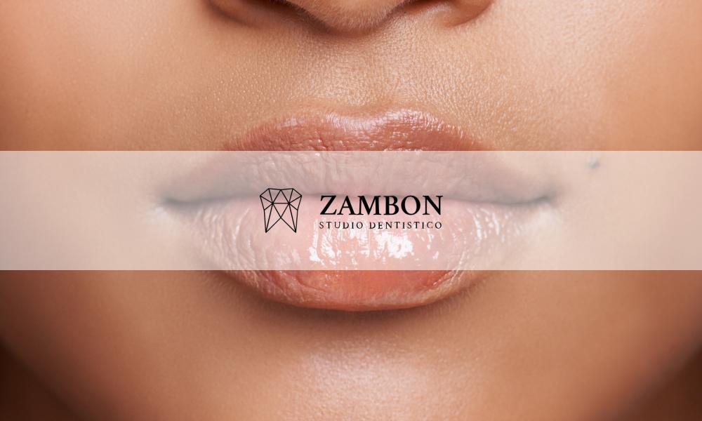 Filler Labbra Padova
