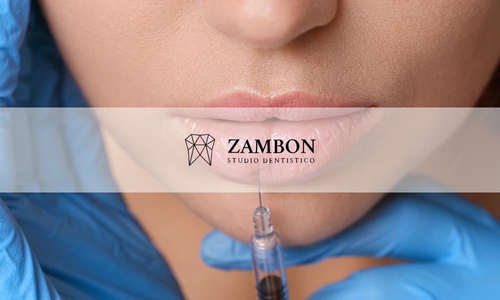Trattamento Filler Labbra Padova